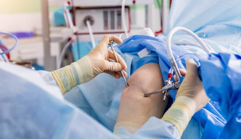 Total Knee Replacement: What to Expect Before, During, and After Surgery